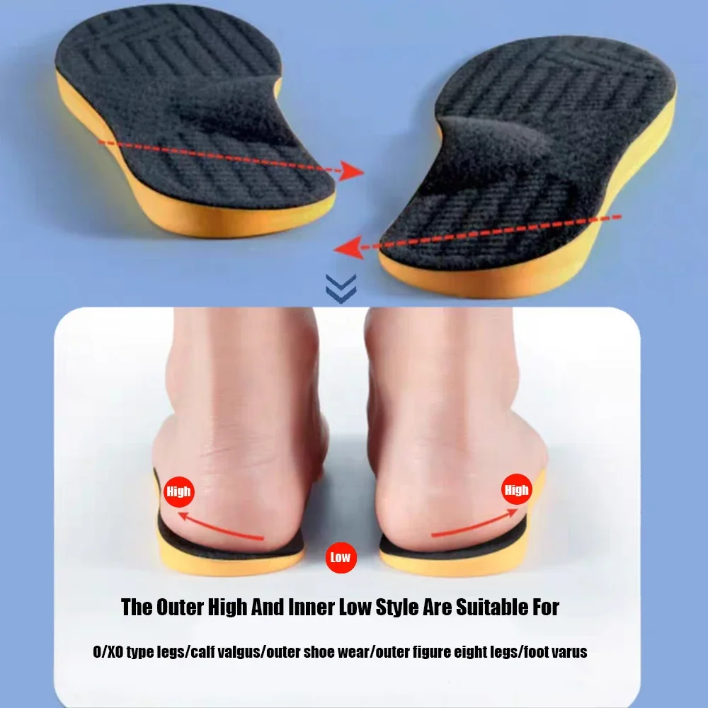 평발용 아치 서포트 깔창 1쌍 O/X 다리 교정용 정형 - Men'S Shoes Plantar Fasciitis 리뷰 및 가격